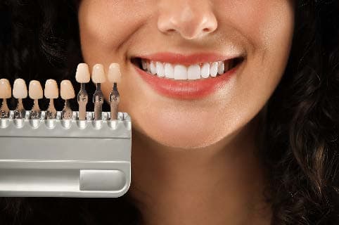 Teeth Whitening